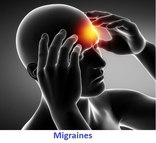 Managing and Preventing Migraines